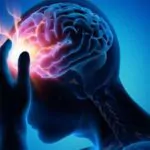 أهم أعراض الجلطة الدماغية والغيبوبة