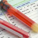 مدة بقاء الهيروين في الجسم و 5 معلومات عن تنظيف الدم والبول