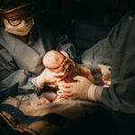 هل يمكن الولادة الطبيعية بعد القيصرية؟| شروط تسهيل الولادة الطبيعية بعد القيصرية