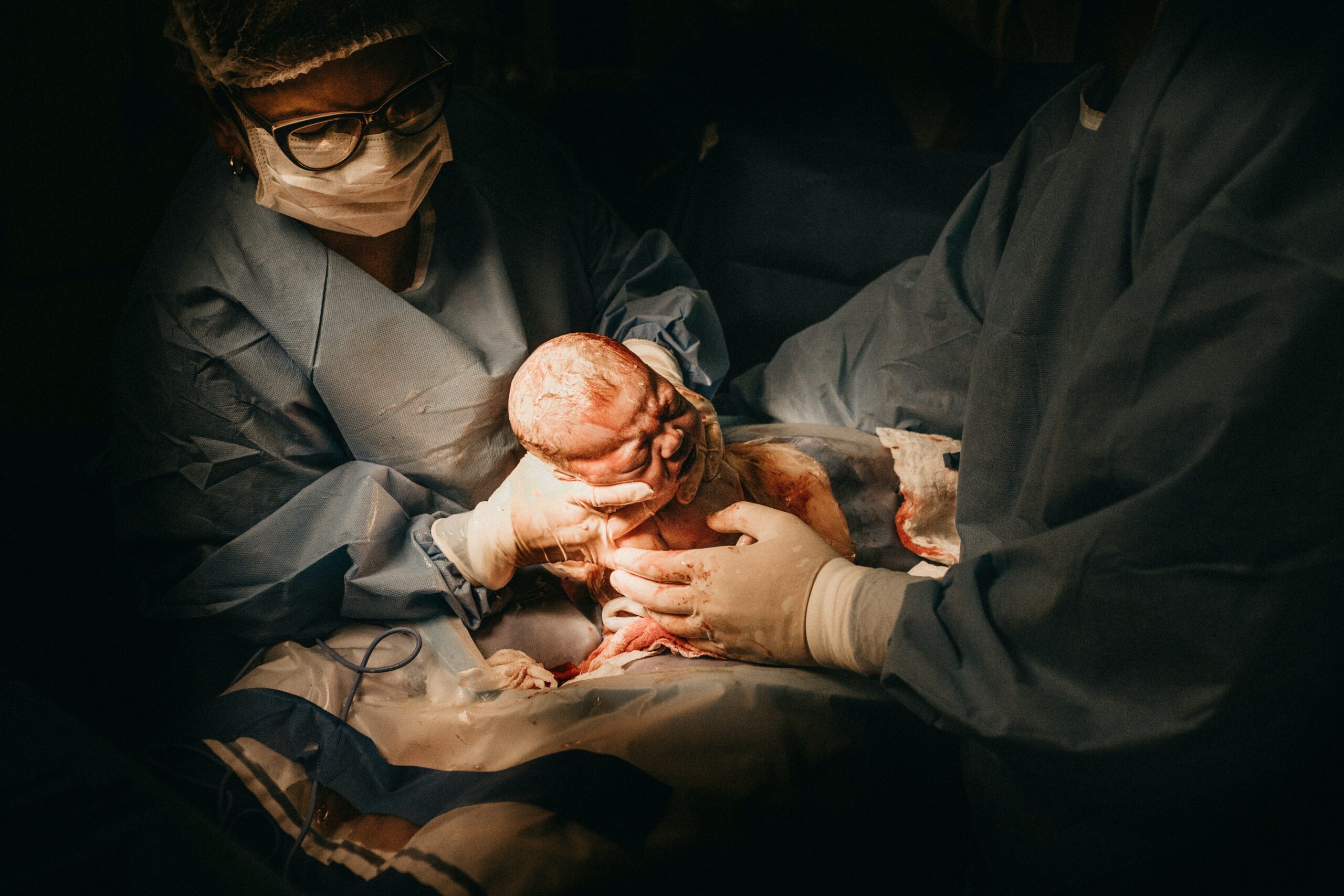 هل يمكن الولادة الطبيعية بعد القيصرية؟| شروط تسهيل الولادة الطبيعية بعد القيصرية