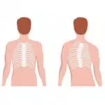 تقنيات متطورة لتصحيح اعوجاج العمود الفقري