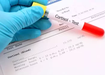 ما هو تحليل الكورتيزول وشروط إجراءه‎