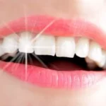 الفوائد الرائعة لزراعة الأسنان في تحسين الوظائف والمظهر الجمالي