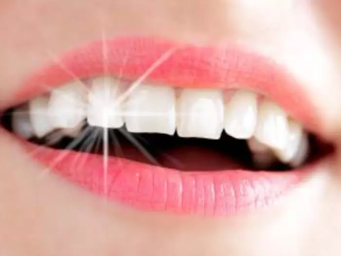 الفوائد الرائعة لزراعة الأسنان في تحسين الوظائف والمظهر الجمالي‎