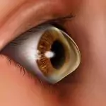 الأعراض الشائعة للقرنية المخروطية 