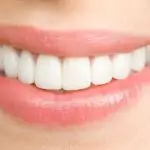 ما هو بديل ابتسامة هوليود؟